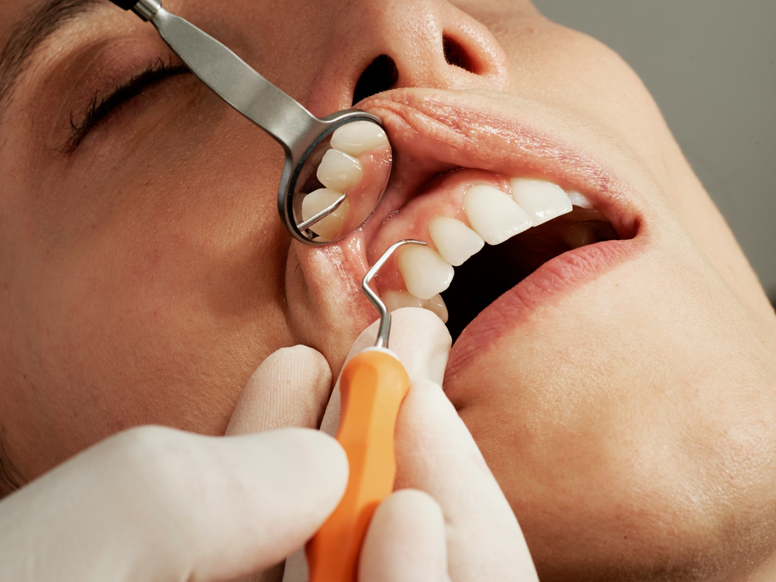 Woman Seeking $16K for Dental Implants Has $9K of Care Credit She Won’t Open Because Interest Could Hurt Her Credit Score — She Refuses to Travel to Mexico for Cheaper Work and Blocks Anyone Who Asks Her to Get a Job