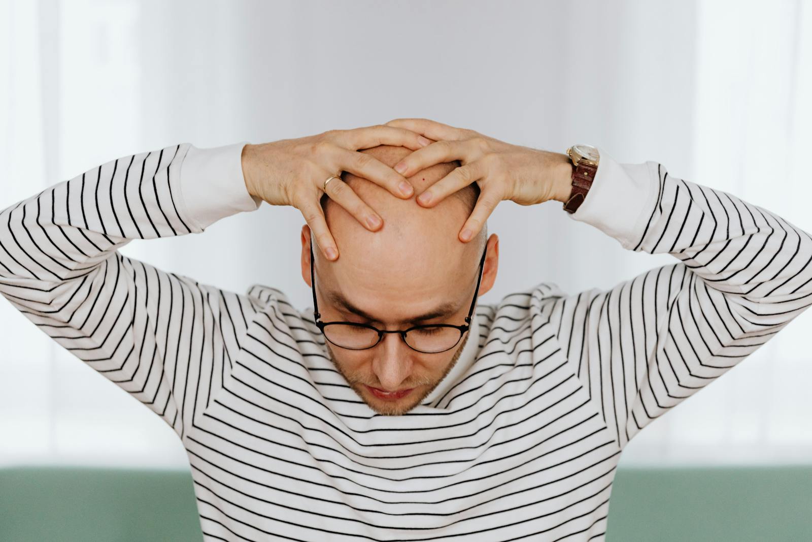 A young bald man in a striped shirt holds his head in stress indoors. Concept of headache and mental tension.